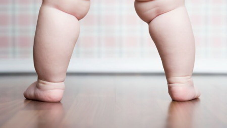 Número de crianças obesas no mundo aumentou 11 vezes em quatro décadas